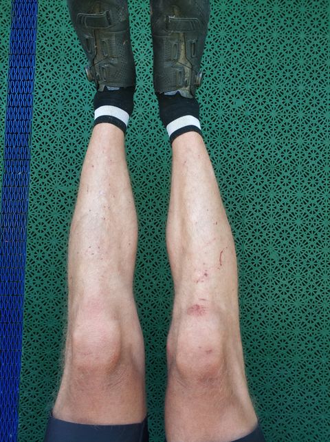 Photo of my legs after crossing some bushes with thorns